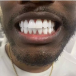 Teeth 3